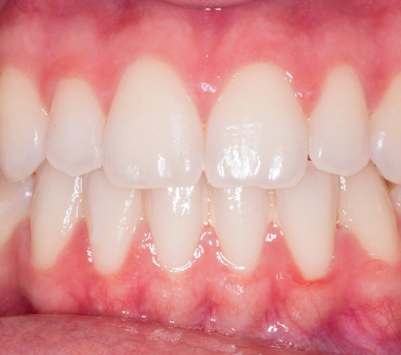 Chesterland Smiles Dental Care