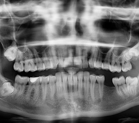 Chesterland Smiles Dental Care