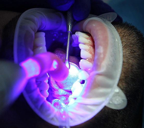 Chesterland Smiles Dental Care